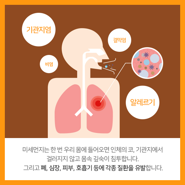 기관지염, 비염, 결막염, 알레르기. 미세먼지는 한 번 우리 몸에 들어오면 인체의 코, 기관지에서 걸러지지 않고 몸속 깊숙이 침투합니다.그리고 폐, 심장, 피부, 호흡기 등에 각종 질환을 유발합니다.